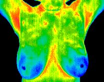 thermograph