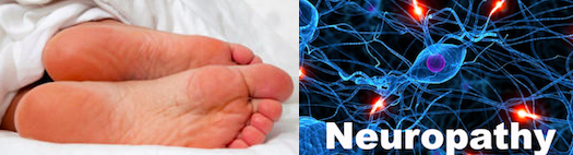 neuropathy