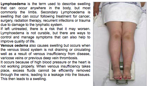 Lymphedema, Chi
                      Machine, Clinical Trials