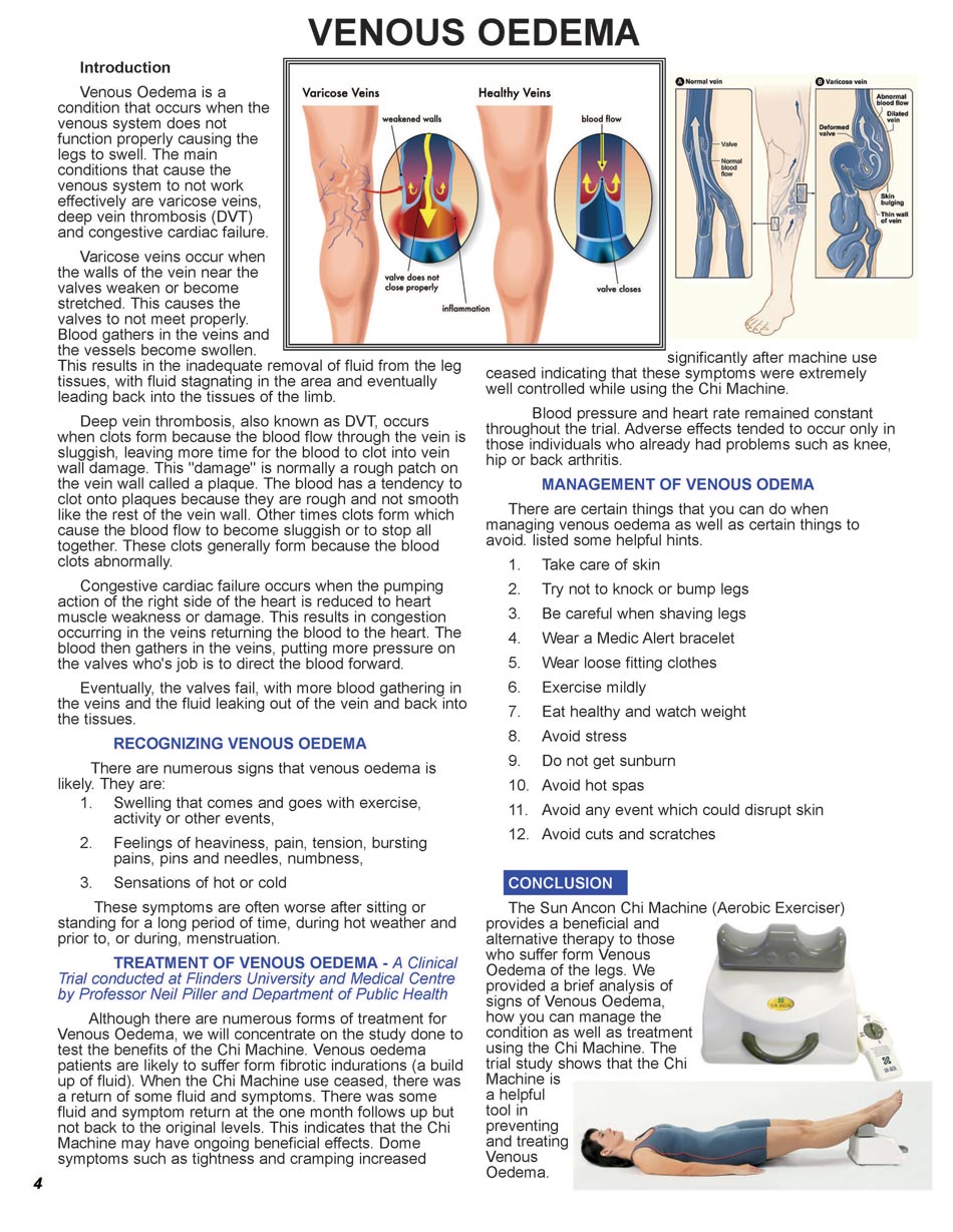 Lymphedema, Lymph Drainage, Chi Machine, Personal Experiences